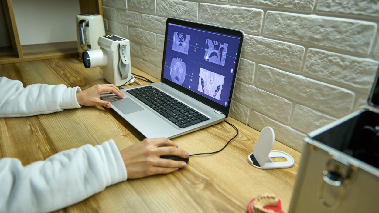 Zbliżenie dłoni lekarza dentysty radiologa analizującego panoramiczne zdjęcie rentgenowskie zębów na monitorze ekranu laptopa w gabinecie stomatologicznym