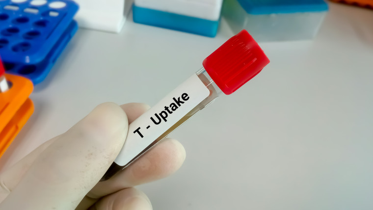 Próbka krwi do testu wychwytu T lub hormonu tarczycy
